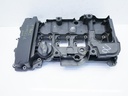 MTD-417635-1
