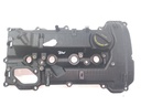 Tapa de balancines Kia Carens 2.0
