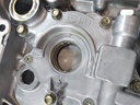 Bomba de aceite Hyundai ix35 2.0 GDi