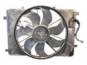 Electroventilador Mercedes-Benz Clase C